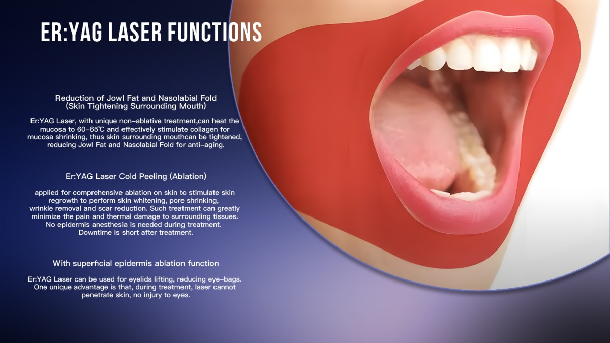 Key-Functions-of-the-2940nm-Erbium-YAG-Laser-Machine