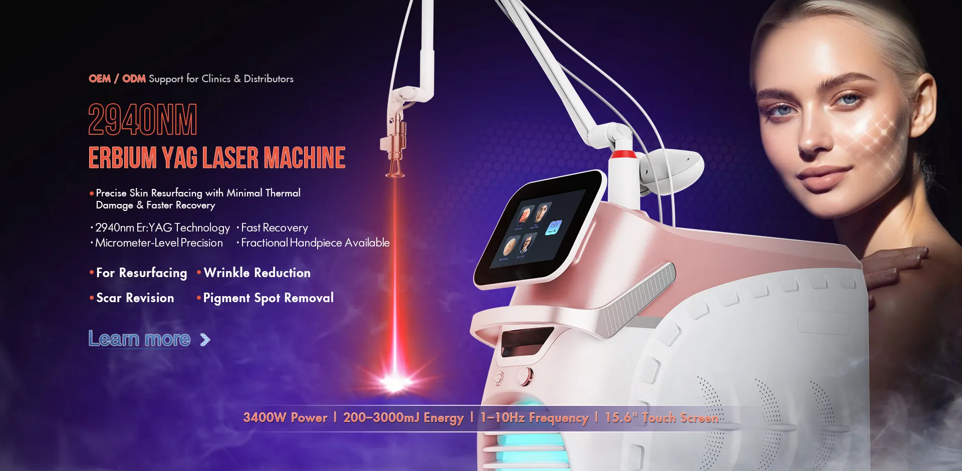 Почему платформа SANHE Laser 2940nm Er:YAG имеет сильное признание на рынке