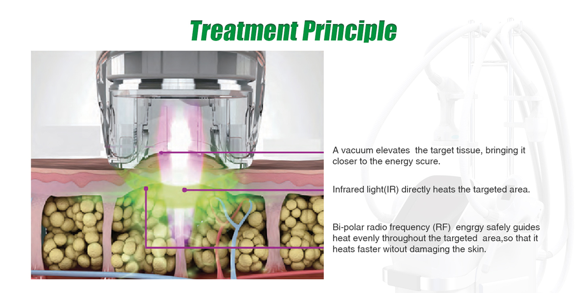 Beauty Machines.jpg Beauty Machines.jpg